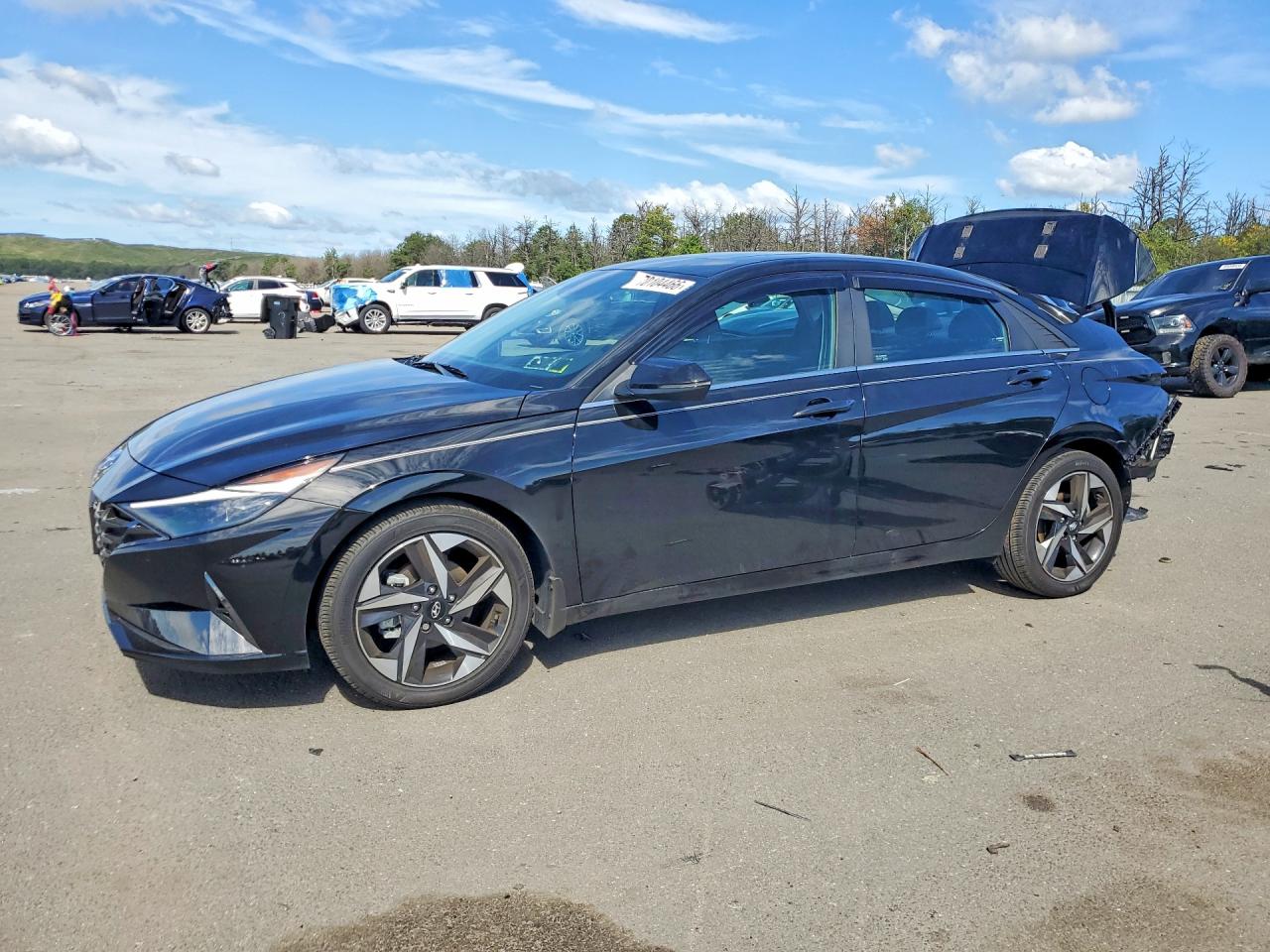 Photo of the 2023 HYUNDAI ELANTRA LIMITED